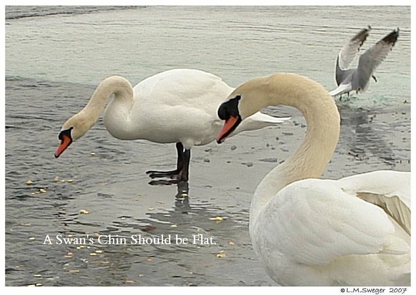 Swan Flat Chin
Swan Under Chin-Tongue Bulge Impaction
