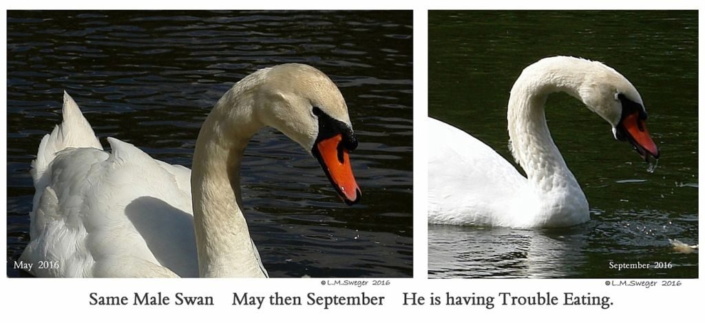 Swan Under Chin-Tongue Bulge Impaction